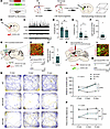 Grafted striatal neuron integrated into host neural circuit and alleviated