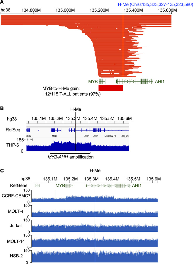 The H-Me is coamplified with MYB in nearly all T-ALL patients with MYB a...