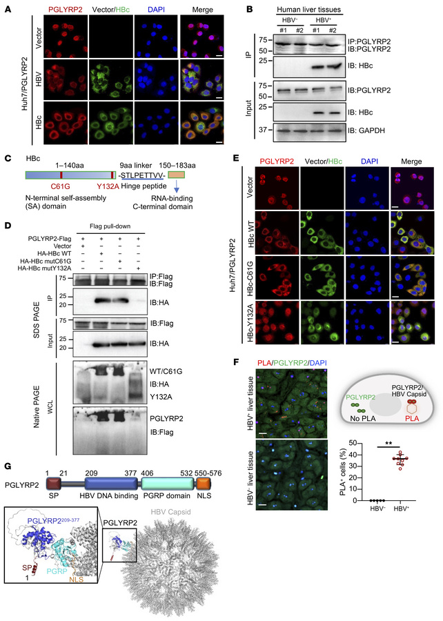 HBV capsid interacts with PGLYRP2 and induces nucleocytoplasmic transloc...