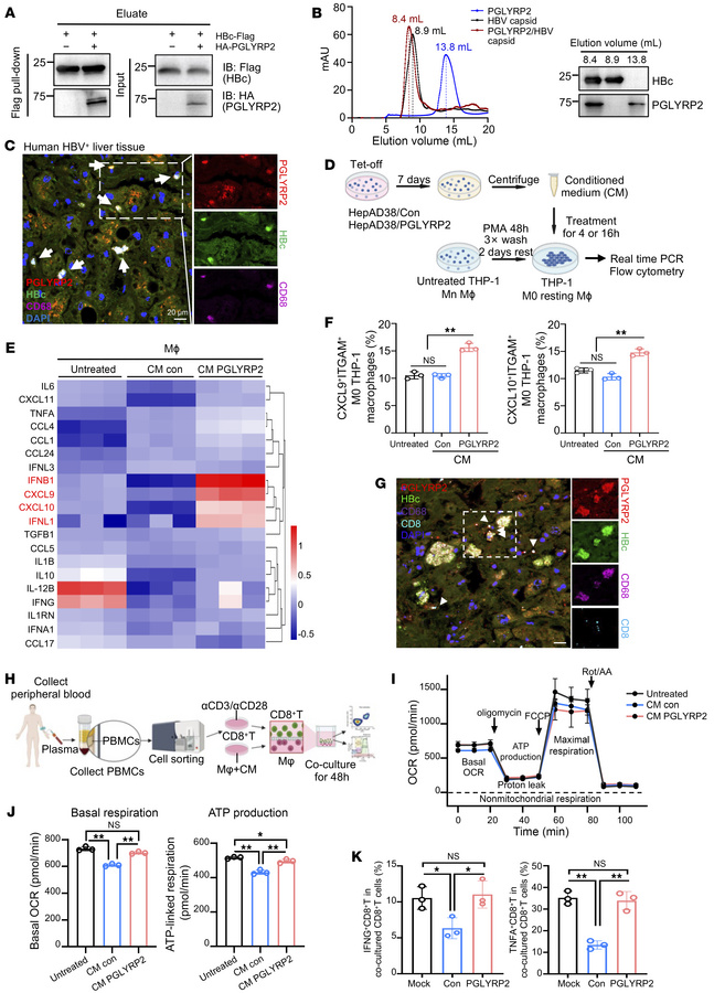 PGLYRP2/HBV capsid complex regulates the functional properties of immune...