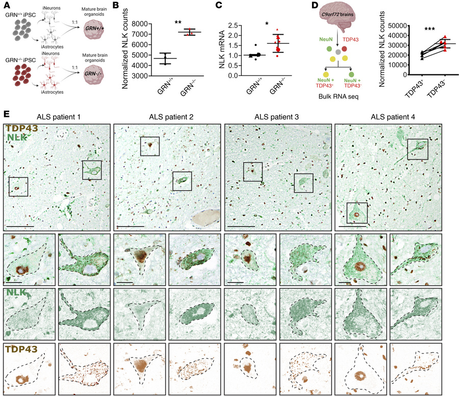 TDP43 pathology is associated with NLK overexpression in human model sys...