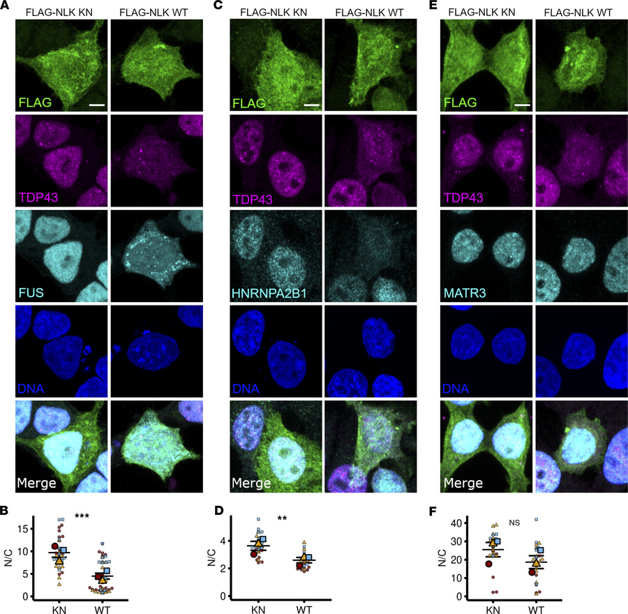 Overexpression of NLK leads to cytoplasmic accumulation of ALS/FTLD–rele...