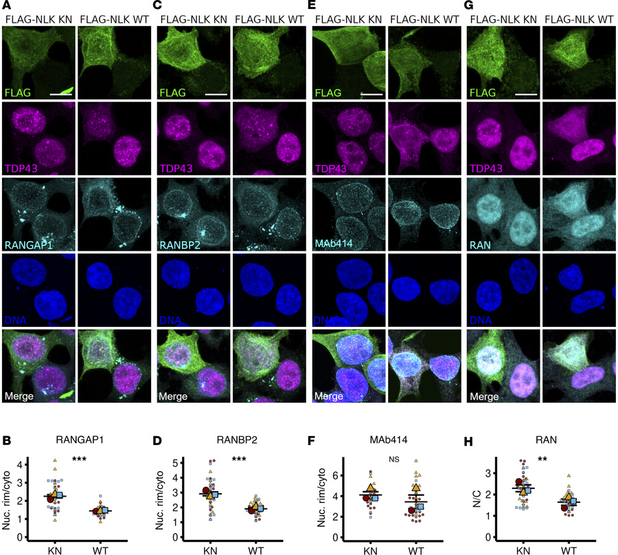 NLK overexpression mislocalizes RanBP2-RanGAP1 and disrupts the Ran grad...
