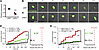 Genetic NLK reduction prevents neurodegeneration in human neuron ALS/FTLD m
