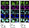 Overexpression of NLK leads to cytoplasmic accumulation of ALS/FTLD–relevan