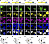 NLK overexpression disrupts NLS-dependent nuclear import.