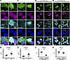 NLK-dependent mislocalization of TDP43 does not depend on nuclear accumulat