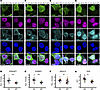NLK overexpression mislocalizes RanBP2-RanGAP1 and disrupts the Ran gradien