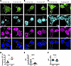 NLK-induced TDP43 mislocalization is RNA independent, but NLK overexpressio