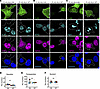 NLK overexpression drives dissolution of nuclear speckles.