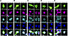 NLK overexpression disrupts nuclear import in primary rat neurons.