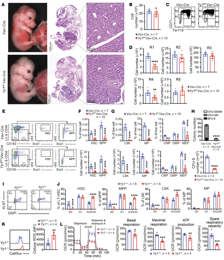 Loss of Yy1 leads to reduction of HSC and progenitor populations in FL.
...
