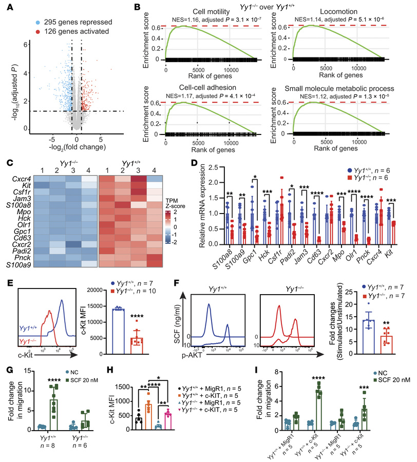YY1 deficiency affects the genetic networks governing cell motility and ...
