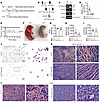 Yy1 deletion during embryonic hematopoiesis leads to neonatal death in mice