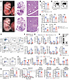 Loss of Yy1 leads to reduction of HSC and progenitor populations in FL.
