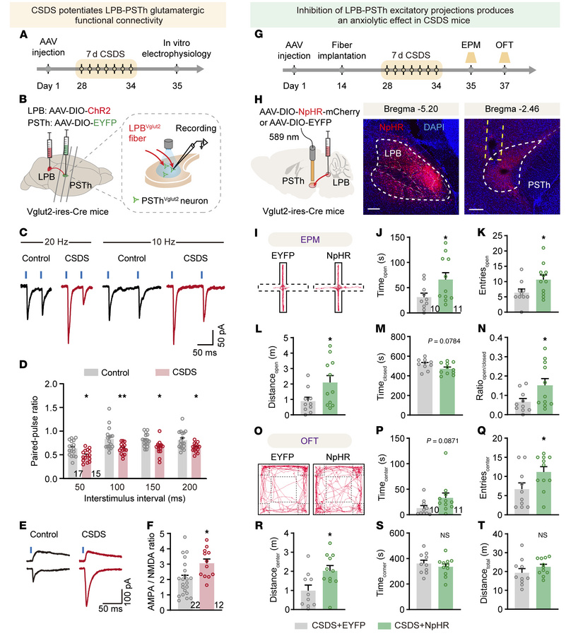 The potentiated LPB-PSTh excitatory pathway mediates anxiety-like behavi...