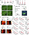 PSTh glutamatergic neurons are activated by various acute stressors.
