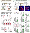 The potentiated LPB-PSTh excitatory pathway mediates anxiety-like behavior