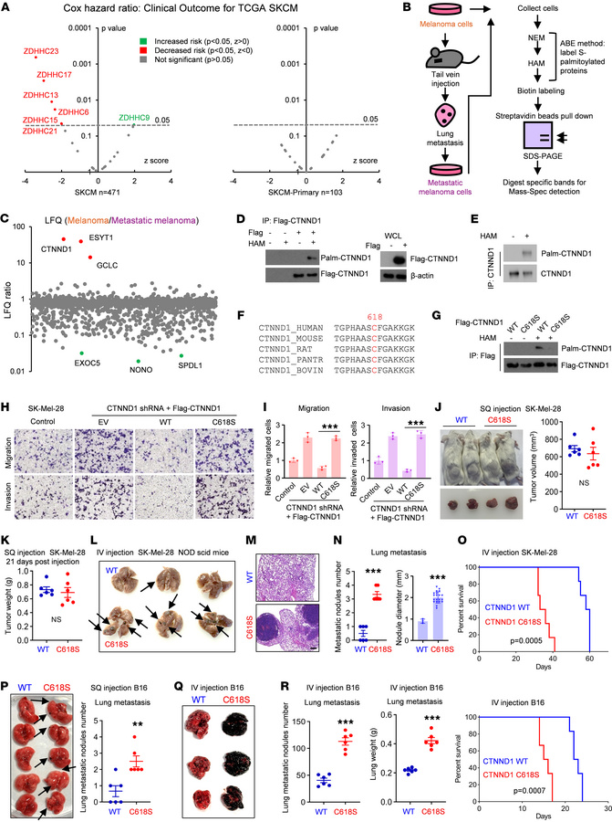CTNND1 palmitoylation delays melanoma metastasis to the lung.
(A) Cox pr...