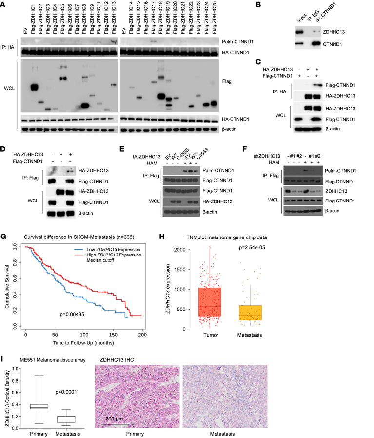 ZDHHC13 acts as the primary PAT for CTNND1 and plays a tumor-suppressive...