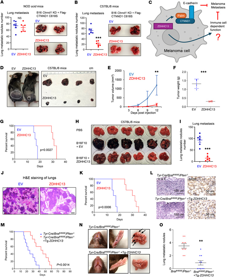 ZDHHC13 suppress melanoma growth and metastasis in immunocompetent mouse...