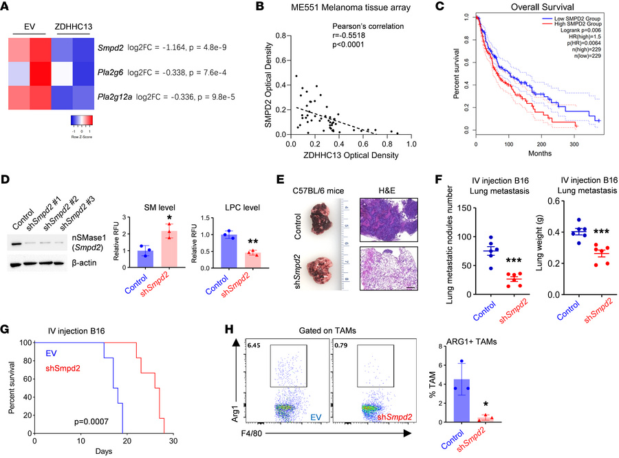 SMPD2 is a downstream of ZDHHC13 to induce M2-like TAM polarization.
(A)...