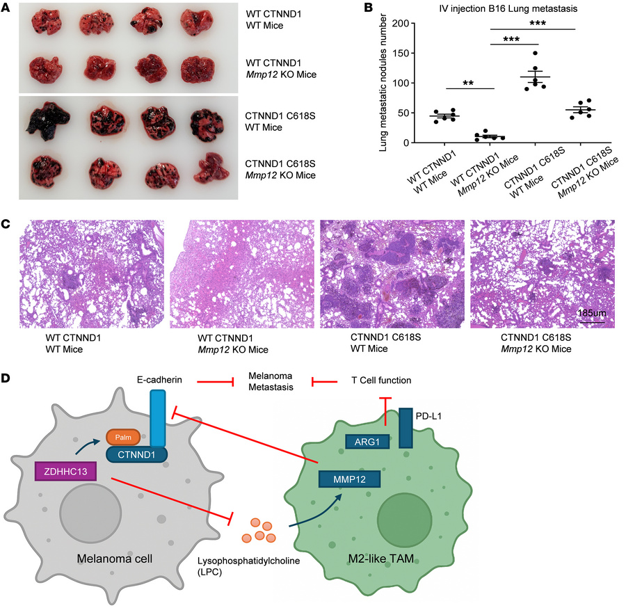 Dual mechanisms of ZDHHC13-mediated melanoma metastasis suppression.
(A)...