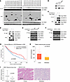 ZDHHC13 acts as the primary PAT for CTNND1 and plays a tumor-suppressive ro
