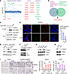 Palmitoylation is essential for the interaction between CTNND1 and E-cadher