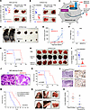 ZDHHC13 suppress melanoma growth and metastasis in immunocompetent mouse.