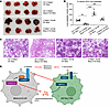 Dual mechanisms of ZDHHC13-mediated melanoma metastasis suppression.
