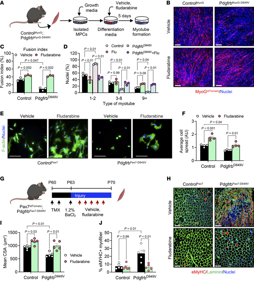 STAT1 mediates PDGFRβ signaling to control myocyte fusion and myofiber r...