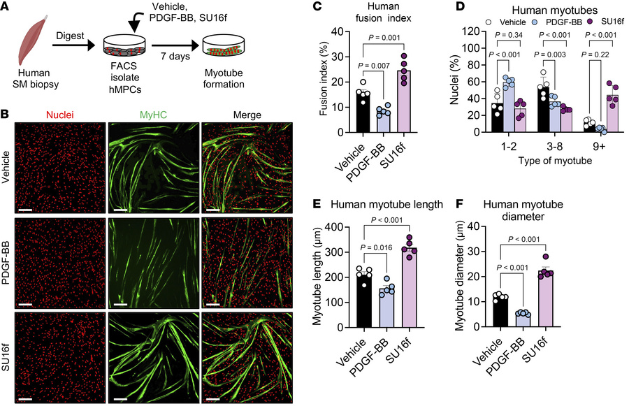 Blocking PDGFRβ signaling in human muscle cells boosts myotube developme...