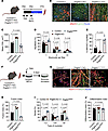 Genetic alteration of Pdgfrb expression changes muscle regeneration and myo