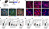 Genetically altering Pdgfrb activity in myocytes modifies muscle regenerati