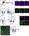 PDGFRβ signaling cooperates with TGF-β signaling to control myocyte morphol