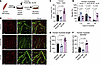 Blocking PDGFRβ signaling in human muscle cells boosts myotube development.