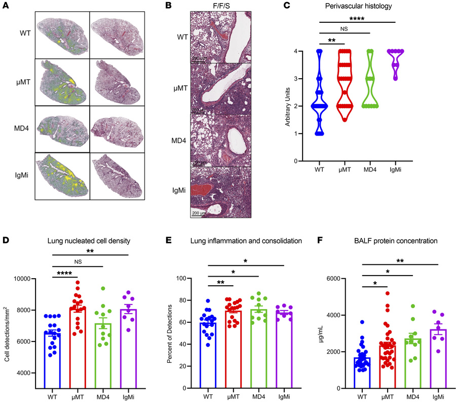 Loss of influenza virus–specific antibody increases lung tissue injury d...