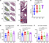 Loss of influenza virus–specific antibody increases lung tissue injury duri