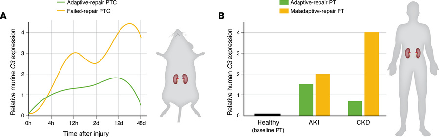 
C3 expression dynamics correspond to failed repair in proximal tubules....
