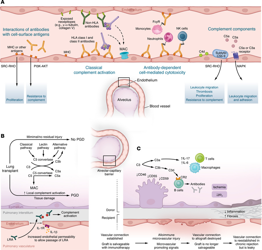 Proposed scenarios and consequences of local complement activation in lu...