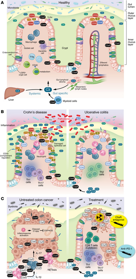 Complement in healthy colon, IBD, and colon cancer.
(A) In healthy colon...