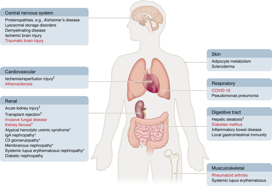 Overview of the complosome in human disease.
Diseases are grouped by org...