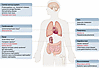 Overview of the complosome in human disease.