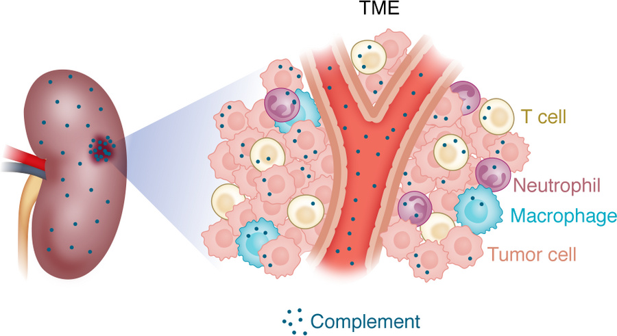 TME in kidney.
Kidney cancer TME is dynamic with hematopoietic cells and...