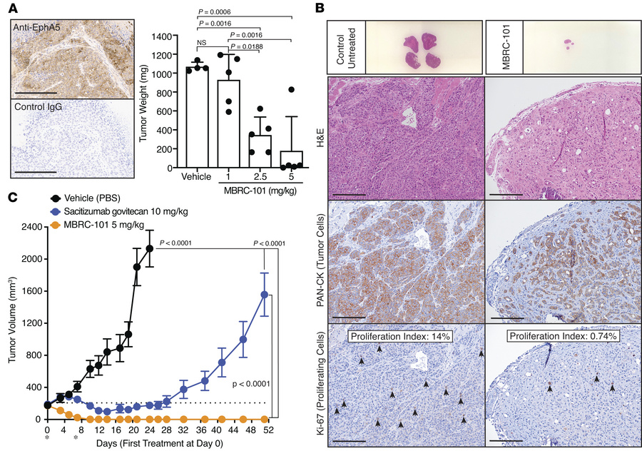 MBRC-101 antitumor activity.
(A) IHC of tissue sections from a PDX model...