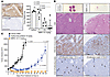 MBRC-101 antitumor activity.