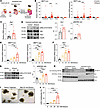 Ethanol activates Zbp1 and induces Mlkl-mediated necroptosis in intestinal