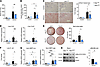 Deficiency of Zbp1 in intestinal epithelial cells attenuates ethanol-induce