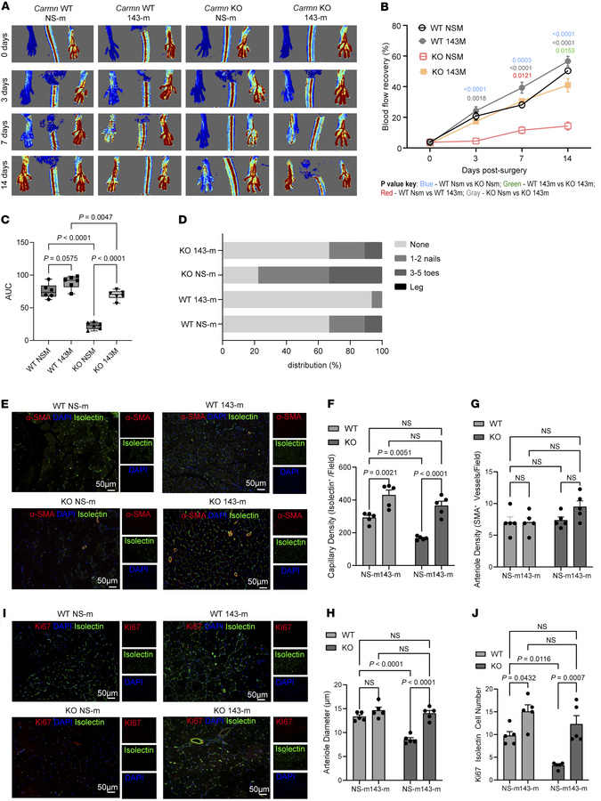 Delivery of miR-143-3p in vivo rescued revascularization in hindlimb isc...